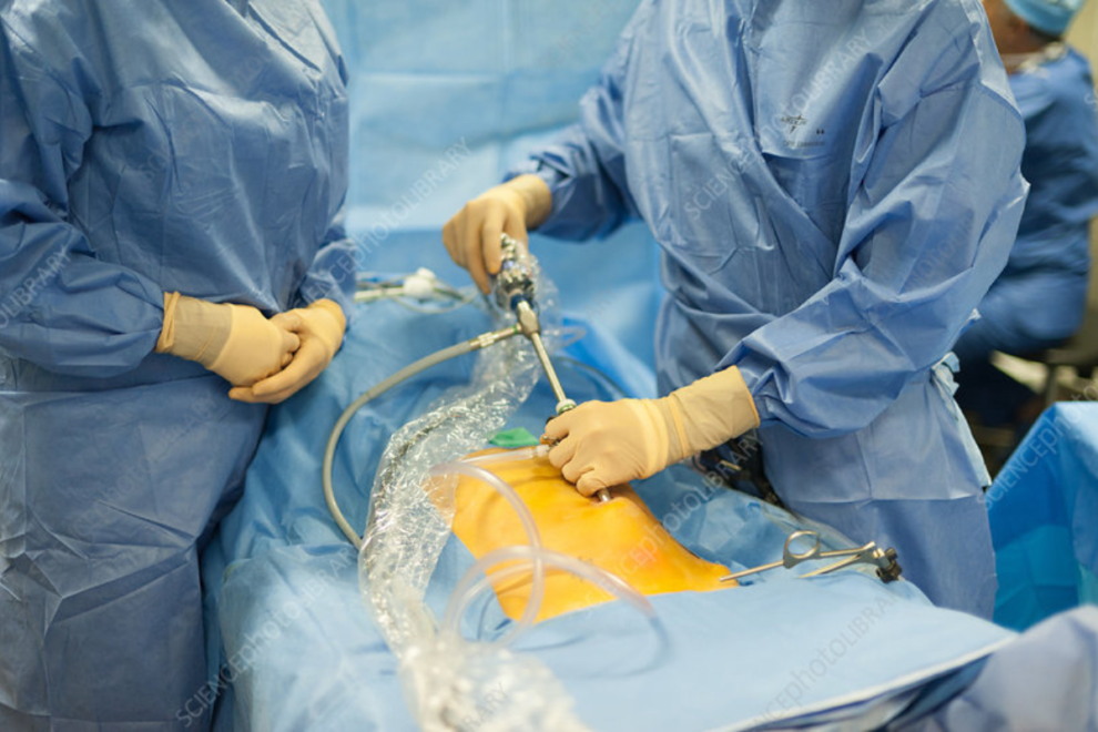 Vesicovaginal Fistula Surgery in India Vesicovaginal Fistula Surgery in India