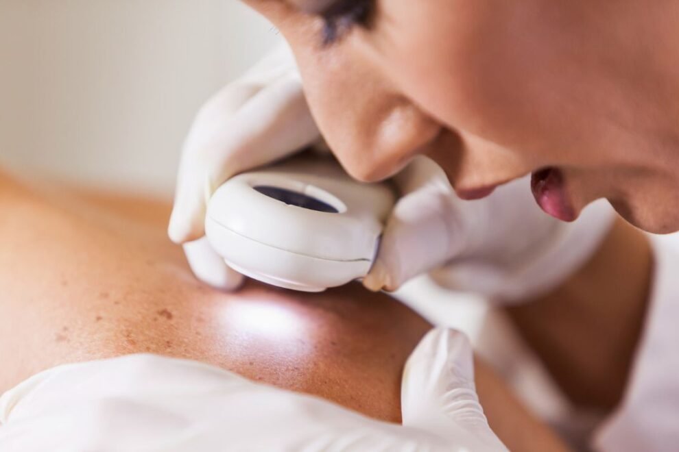 Adjuvant Therapy in India Adjuvant Therapy in India