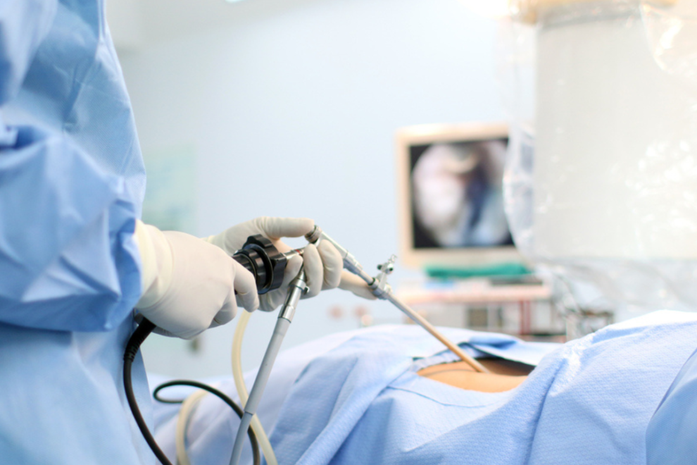 Appendectomy Surgery Appendectomy Surgery