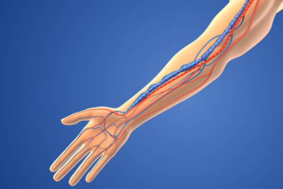 Arteriovenous Fistulas Surgery in India Arteriovenous Fistulas Surgery in India