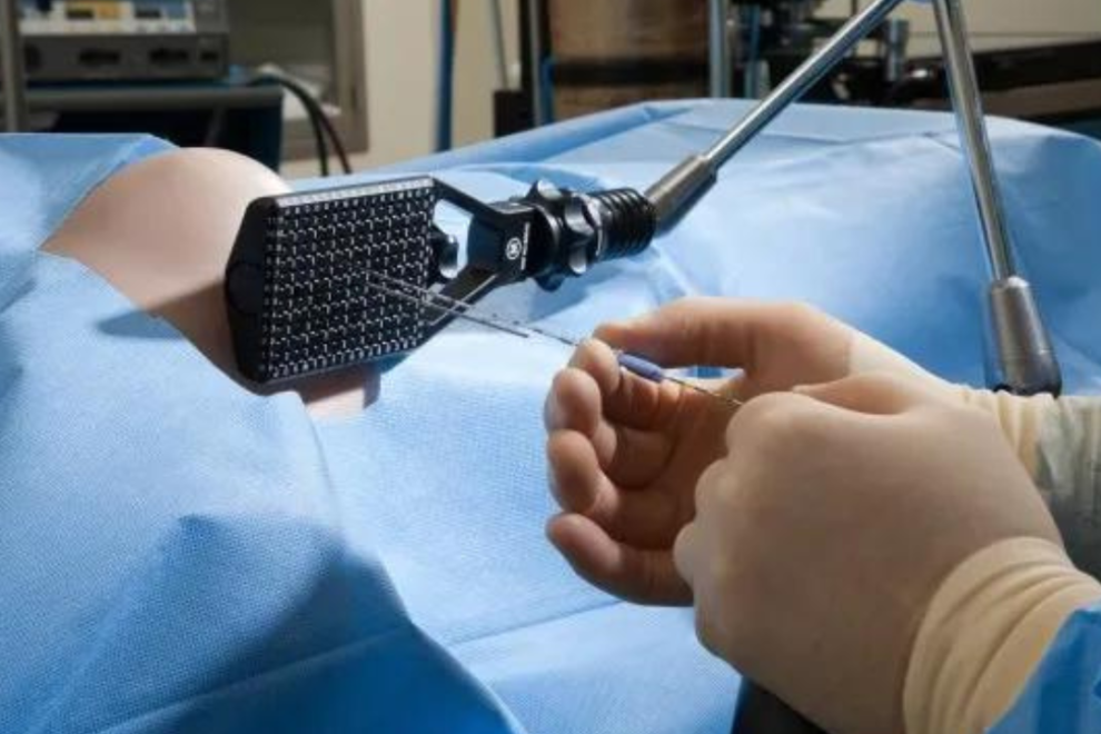 Brachytherapy Brachytherapy