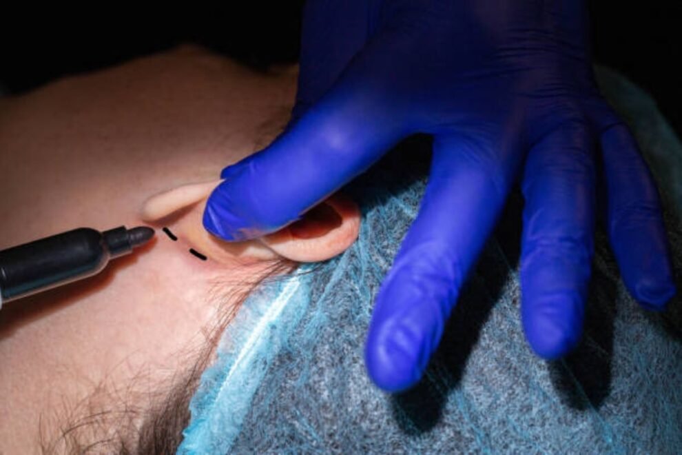 Grommet Removal Surgery in India: Safe Procedures for Ear Health Grommet Removal Surgery in India: Safe Procedures for Ear Health