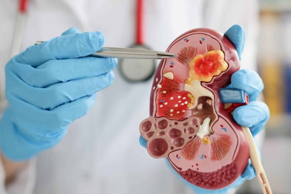 Renal Insufficiency Treatment in India: Advanced Kidney Care Solutions Renal Insufficiency Treatment in India: Advanced Kidney Care Solutions