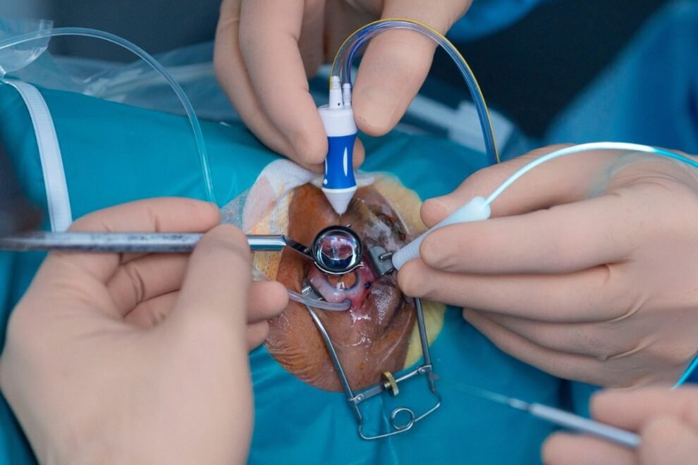 Retinal Surgery: Advanced Treatment Options for Vision Restoration | Expert Eye Care Retinal Surgery: Advanced Treatment Options for Vision Restoration | Expert Eye Care