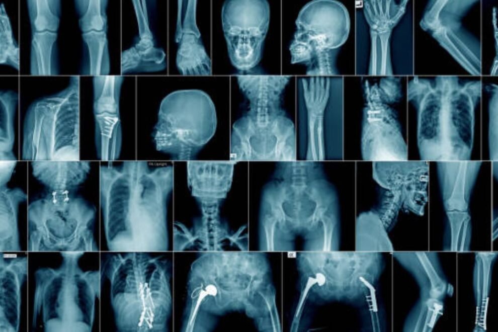 Retrograde Pyelogram Surgery in India Procedure, Cost & Best Hospitals Retrograde Pyelogram Surgery in India: Procedure, Cost & Best Hospitals