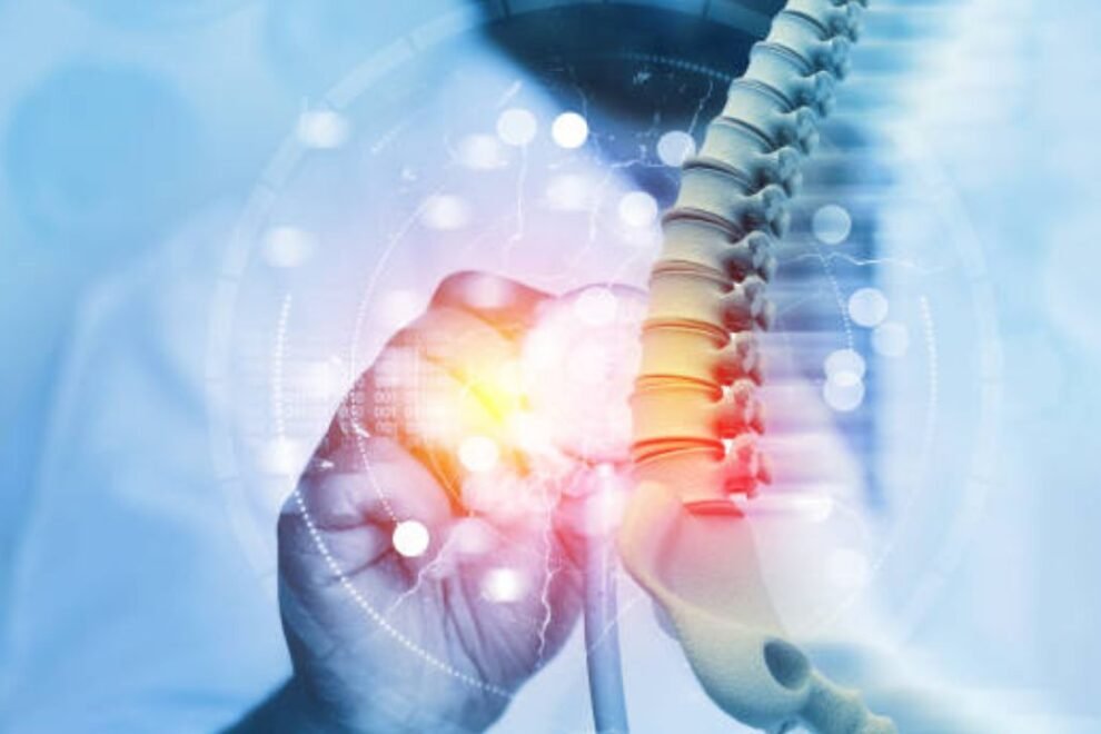 Radiofrequency Occlusion Surgery in India Effective Varicose Vein Treatment Radiofrequency Occlusion Surgery in India Effective Varicose Vein Treatment