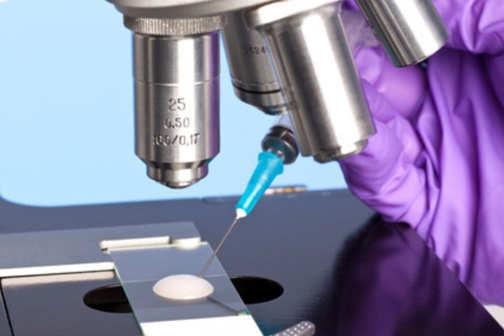 Semen Analysis: Purpose, Procedure & What to Expect
