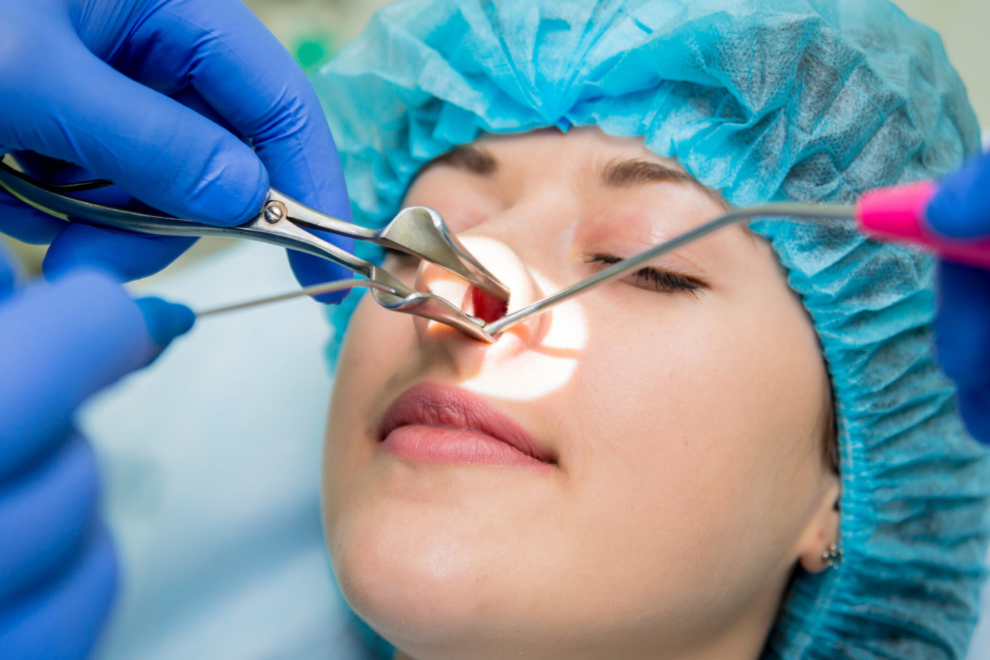 Sinus Surgery in India Sinus Surgery in India