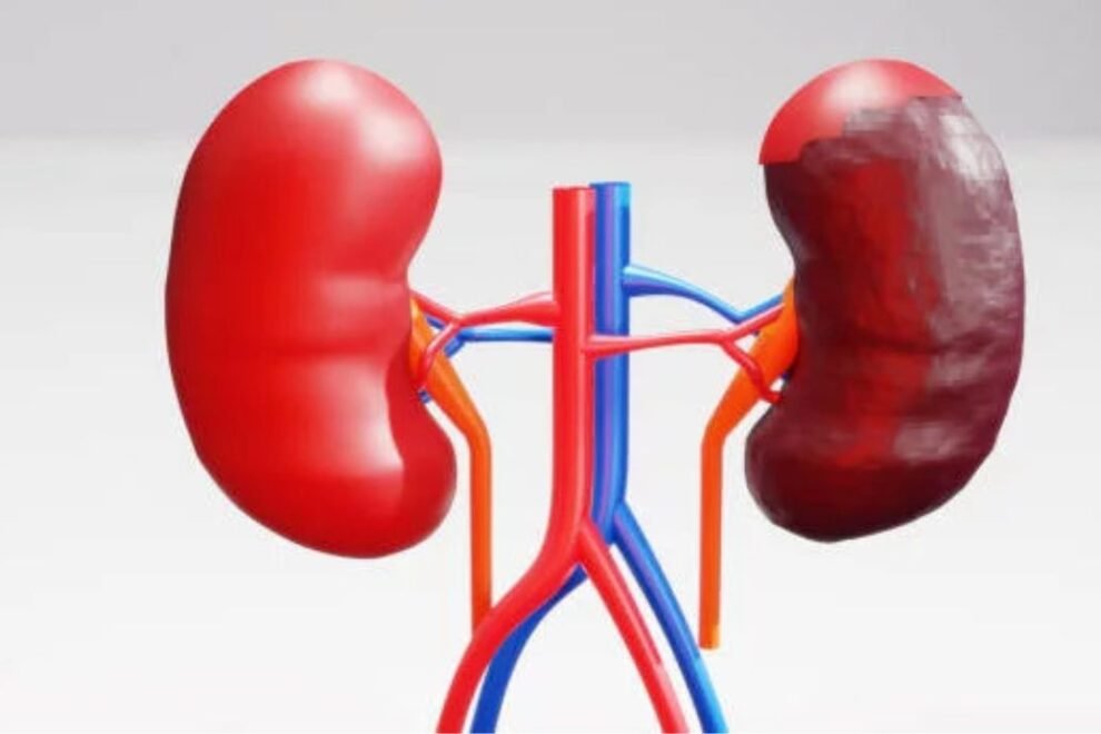 Affordable Radical Nephrectomy in India: Top Hospitals & Surgeons Affordable Radical Nephrectomy in India: Top Hospitals & Surgeons