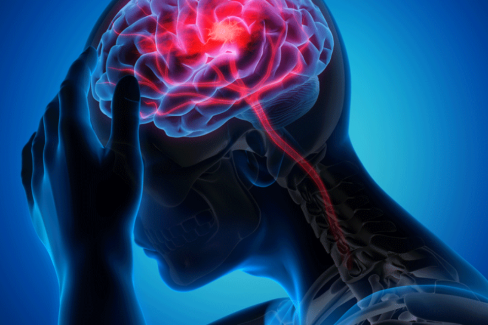 Endovascular Treatment Endovascular Treatment
