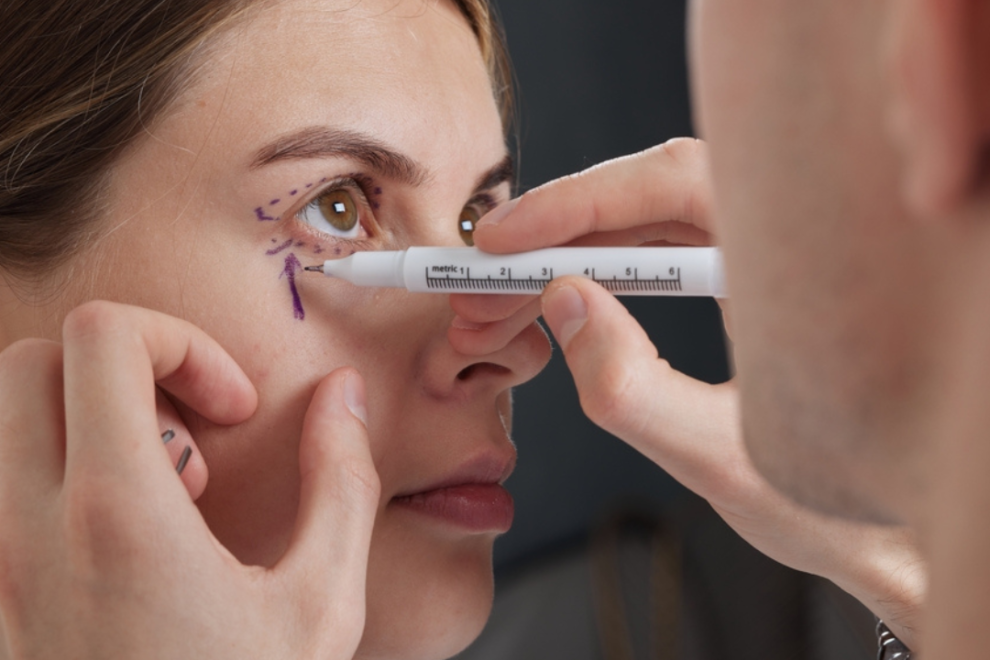 Eye Muscle Surgery in India Eye Muscle Surgery in India