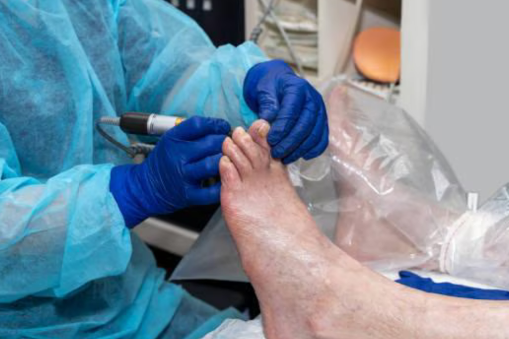 Foot Surgery in India Foot Surgery in India