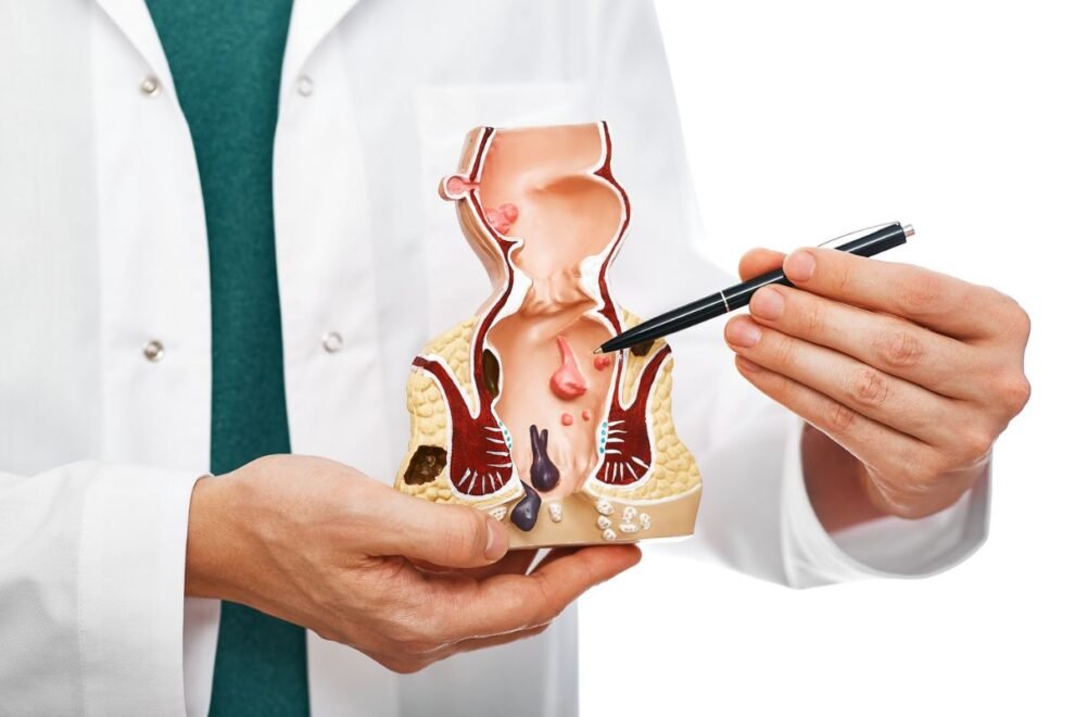 Hemorrhoidectomy in India – Advanced Hemorrhoid Treatment & Surgery Hemorrhoidectomy in India – Advanced Hemorrhoid Treatment & Surgery