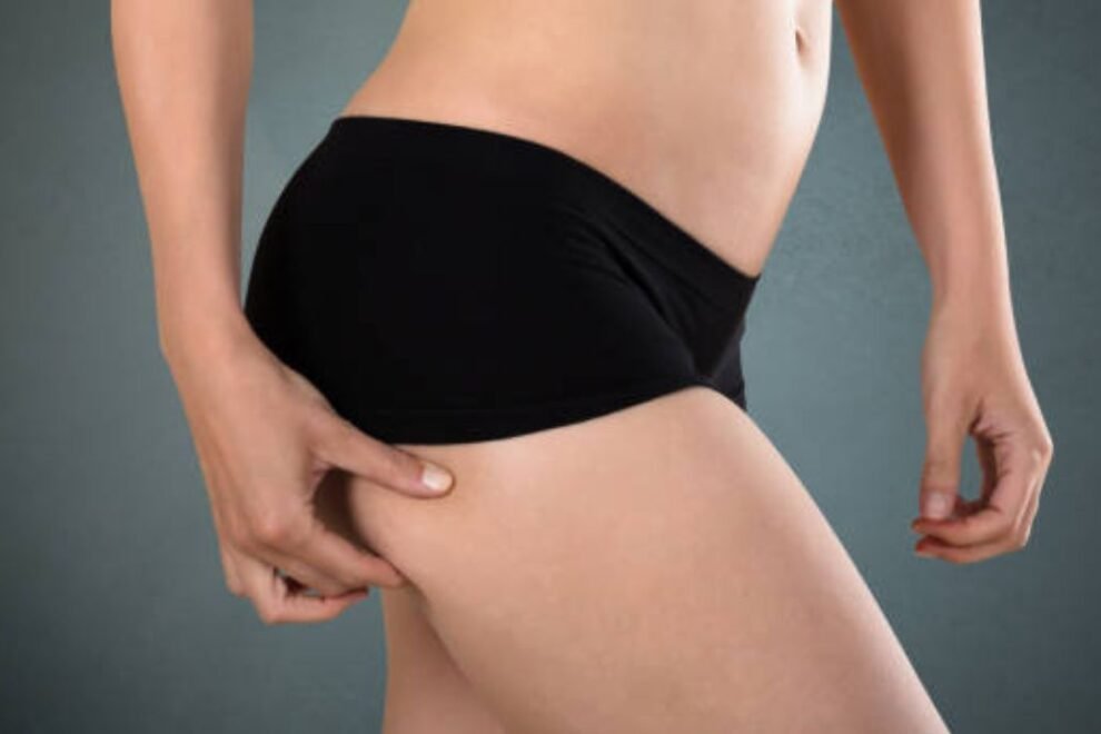 Hip Replacement in India Hip Replacement in India