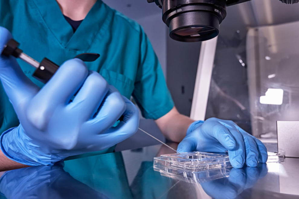 IVF Procedure IVF Procedure