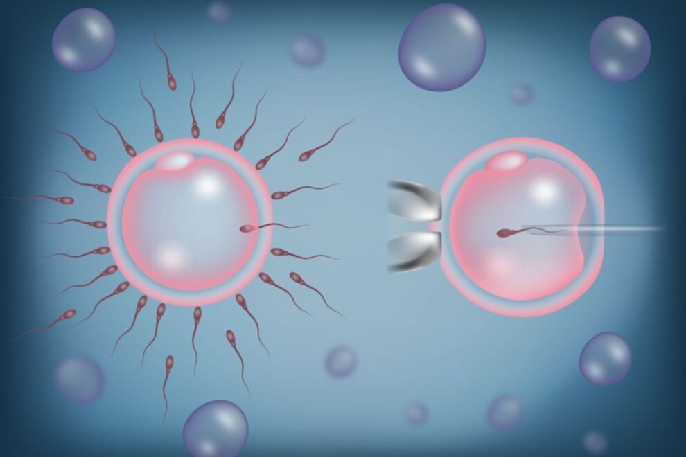 IVFICSI Treatment in India – Affordable Fertility Solutions & Success Rates IVFICSI Treatment in India – Affordable Fertility Solutions & Success Rates