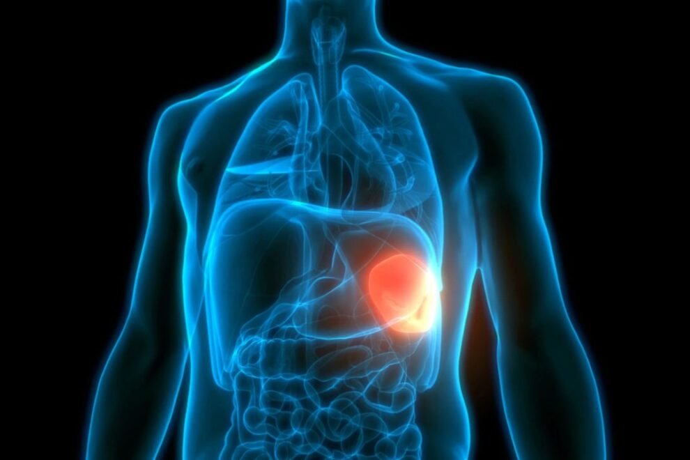 Laparoscopic Splenectomy in India: Safe & Minimally Invasive Surgery Options Laparoscopic Splenectomy in India: Safe & Minimally Invasive Surgery Options