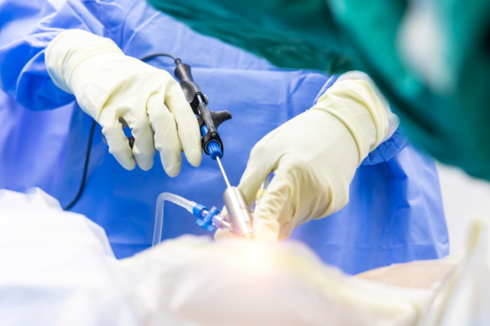 Micro lumbar discectomy Micro lumbar discectomy