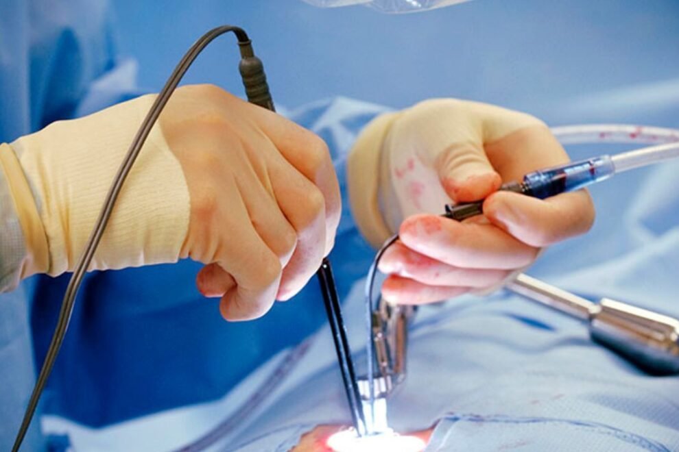 NON Cardiothoracic Surgery in India Non-cardiothoracic surgery in India encompasses a wide range of surgical procedures outside of the heart and thoracic region, including orthopedics, gastrointestinal, urological, and plastic surgeries. With a reputation for high-quality healthcare, India is home to numerous state-of-the-art hospitals equipped with advanced technologies and highly skilled surgeons specializing in various non-cardiothoracic specialties. Patients can expect personalized treatment plans tailored to their specific conditions, along with comprehensive preoperative evaluations and postoperative care. The affordability of non-cardiothoracic surgeries in India makes it an appealing option for both domestic and international patients seeking quality care at lower costs than in Western countries. Indian healthcare facilities prioritize patient safety and satisfaction, ensuring that each surgical procedure is conducted with precision and expertise.