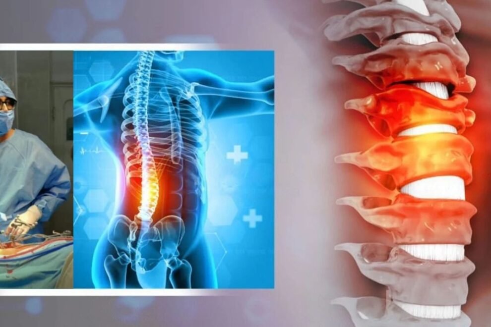 Other Spine Surgeries in India: Best Hospitals & Surgeons for Spine Treatments Other Spine Surgeries in India: Best Hospitals & Surgeons for Spine Treatments