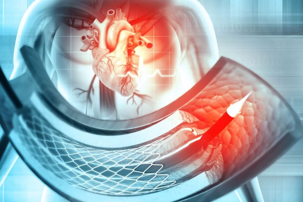 PDA Surgery In India: Affordable Patent Ductus Arteriosus Treatment Options PDA Surgery In India: Affordable Patent Ductus Arteriosus Treatment Options