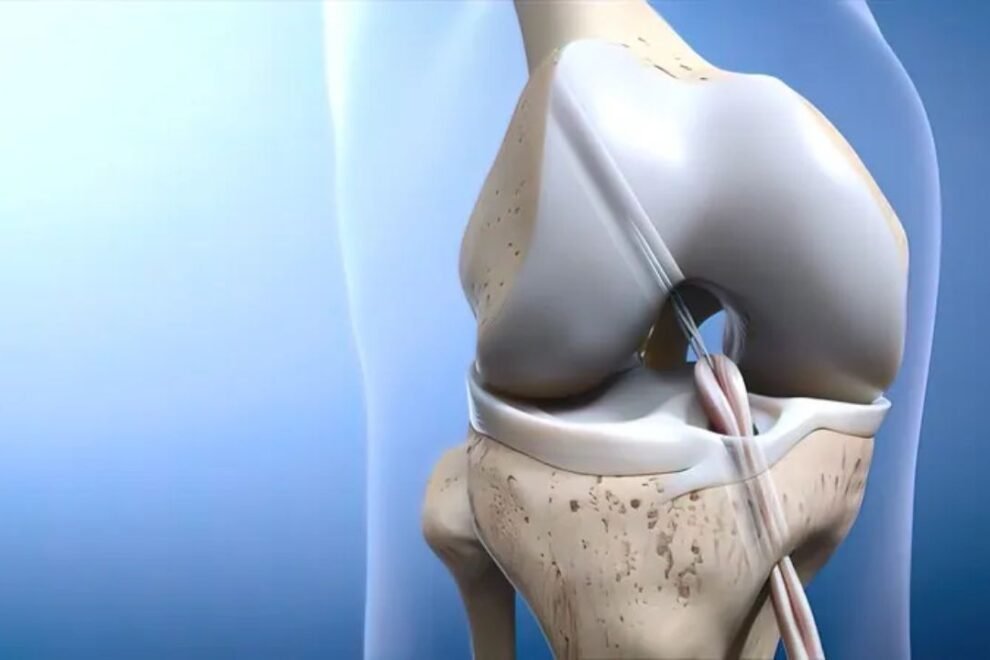 Partial Knee Replacement Surgery in India: Expert Care & Advanced Techniques Partial Knee Replacement Surgery in India: Expert Care & Advanced Techniques