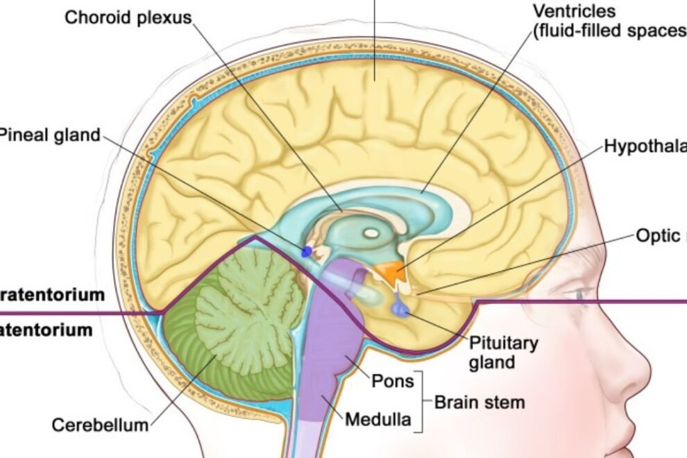 Pineal Region Tumors in India: Symptoms, Diagnosis, and Treatment Options Pineal Region Tumors in India: Symptoms, Diagnosis, and Treatment Options