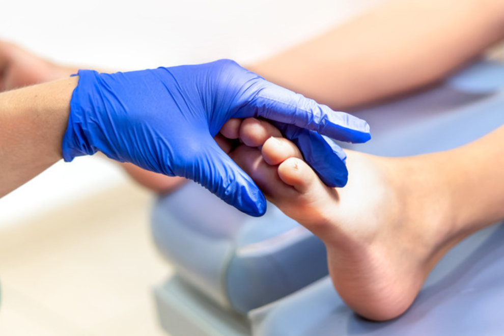 cholesterol embolism surgery in India cholesterol embolism surgery in India