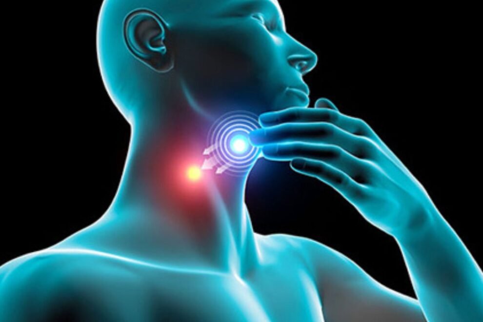 Head & Neck Cancer Treatment in India Head & Neck Cancer Treatment in India