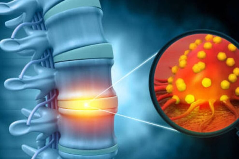 Musculoskeletal Cancer Treatment in India (1) Musculoskeletal Cancer Treatment in India (1)