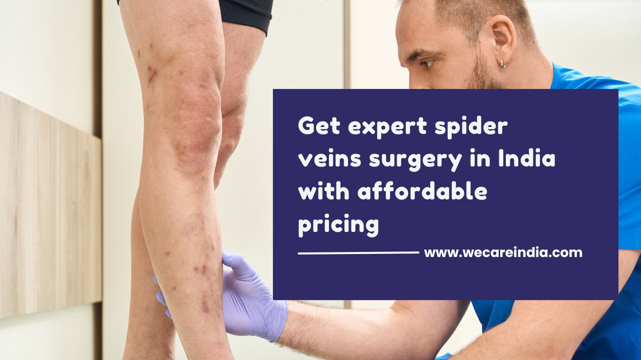 Spider Veins Surgery in India
